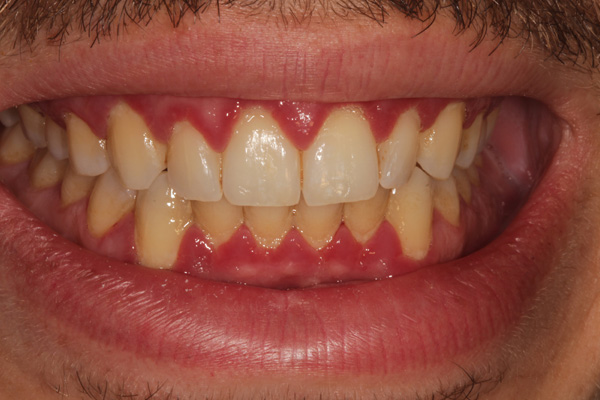hygienist case before 1