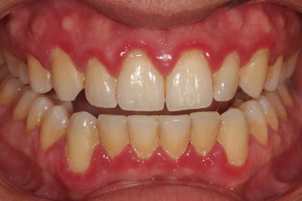 hygienist case before 3