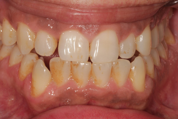 hygienist case before 4