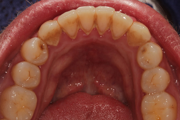 hygienist case before 5